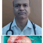 అరుదైన శస్త్ర చికిత్స.. ఏడున్నర కేజీల కంతి తొలగింపు..