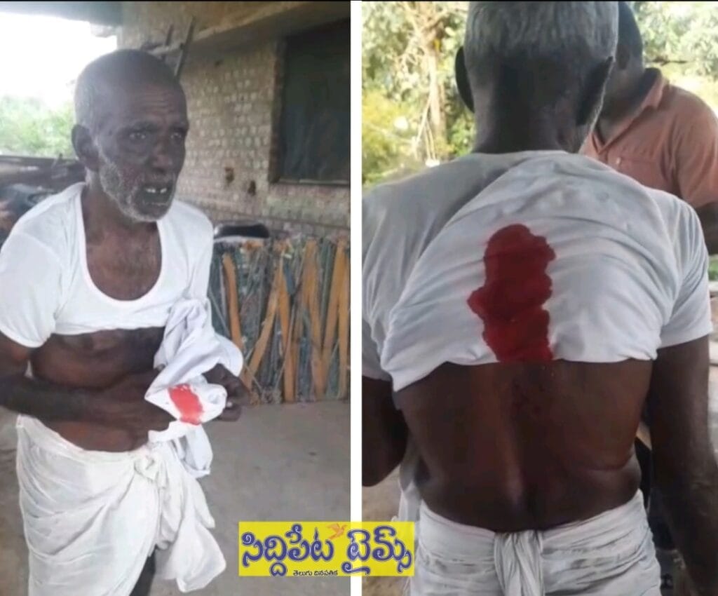 ధూళిమిట్టలో వృద్ధుడిపై కోతుల దాడి… తీవ్ర గాయాలపాలైన వృద్ధుడు